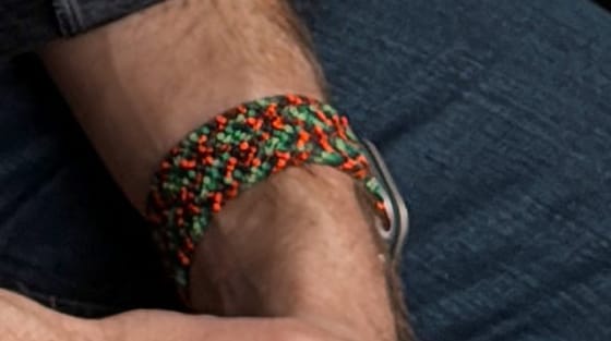 Closeup of a wrist wearing an Apple Watch with a Braided Solo Loop band, with interwoven strands of red, green, and black.